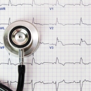 نوار قلب EKG