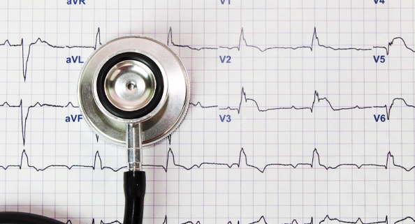 نوار قلب EKG