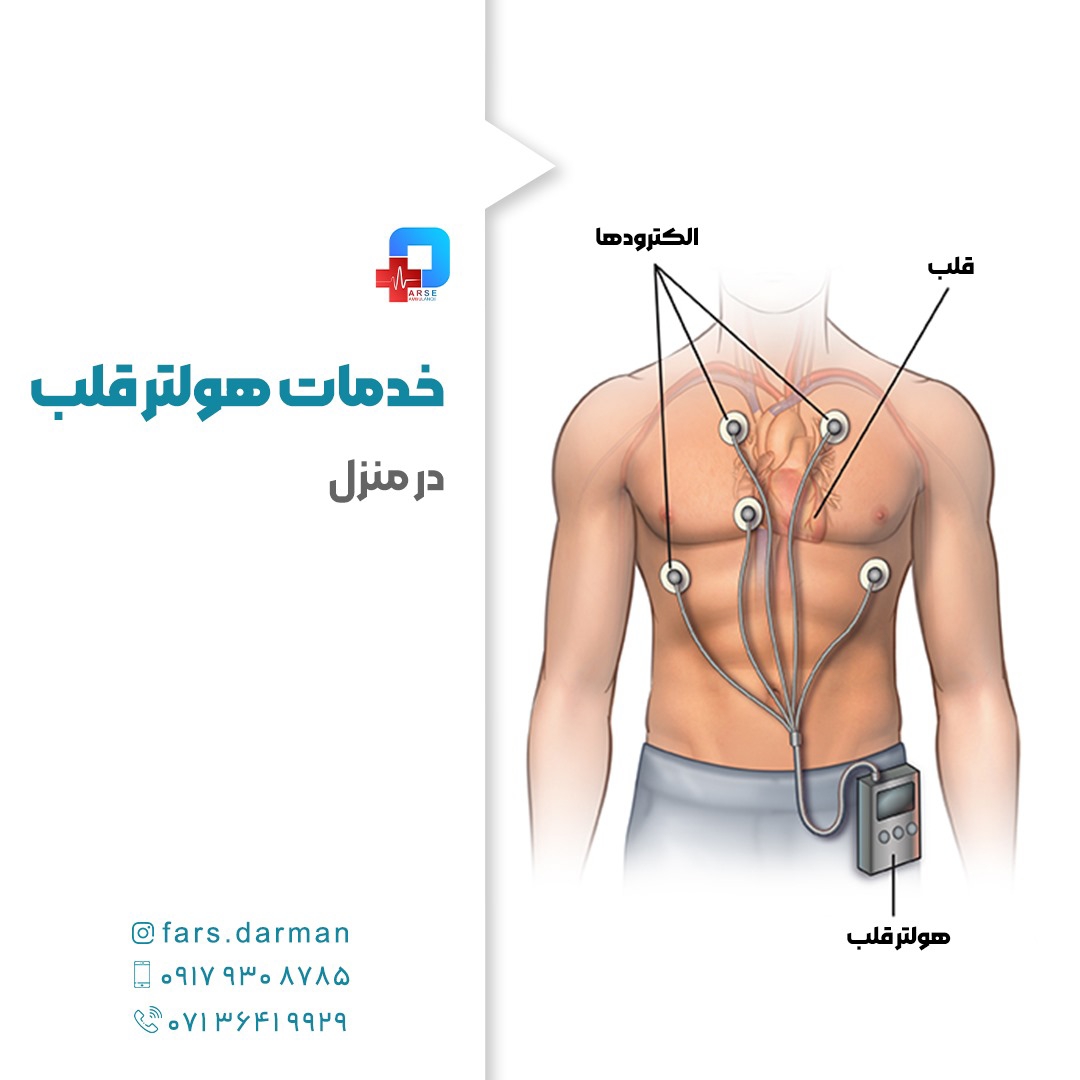 اجاره هولتر قلب در شیراز